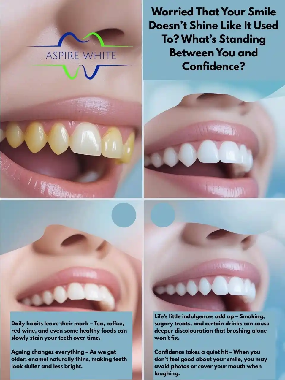Worried That Your Smile Doesn’t Shine Like It Used To What’s Standing Between You and Confidence Kettering